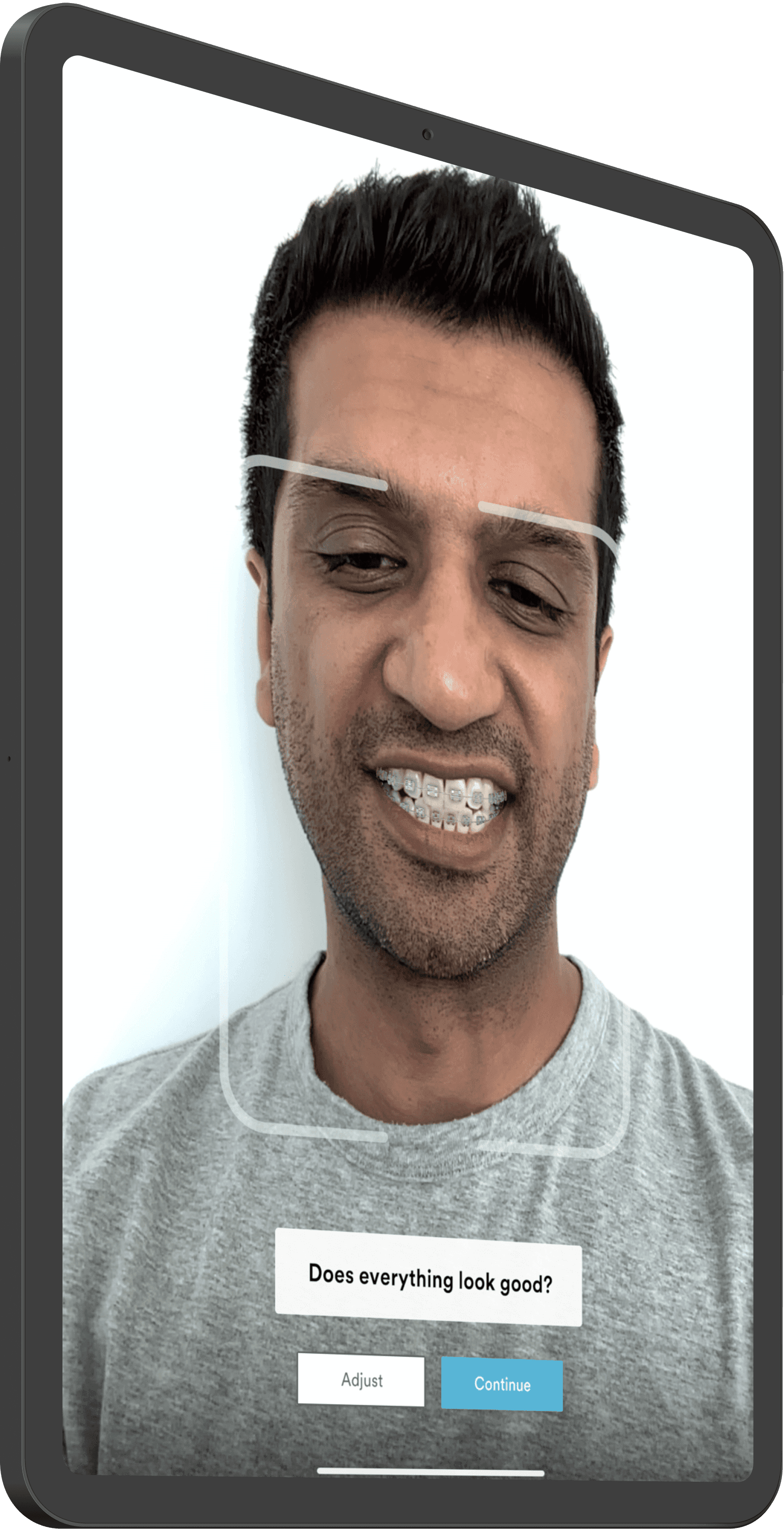 Tx Selector™ screenshot showing a user adjusting the position of their braces