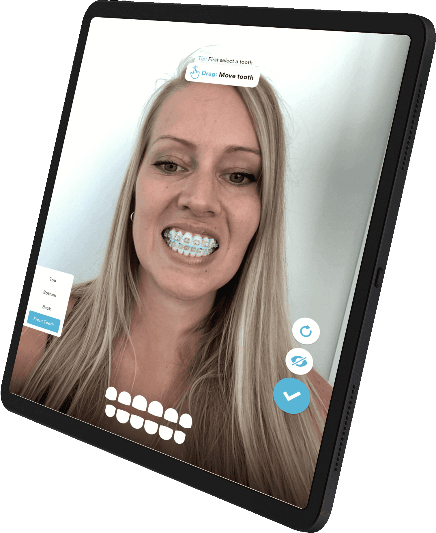 iPad showing a woman using AR to see how braces look on her teeth