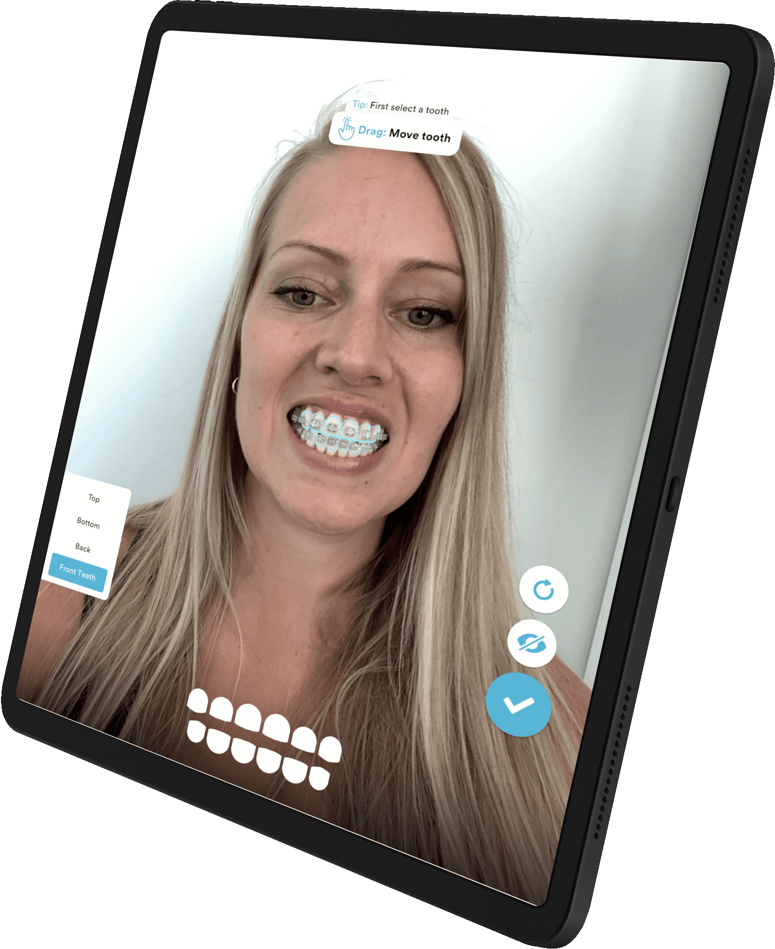 iPad showing a woman using AR to see how braces look on her teeth